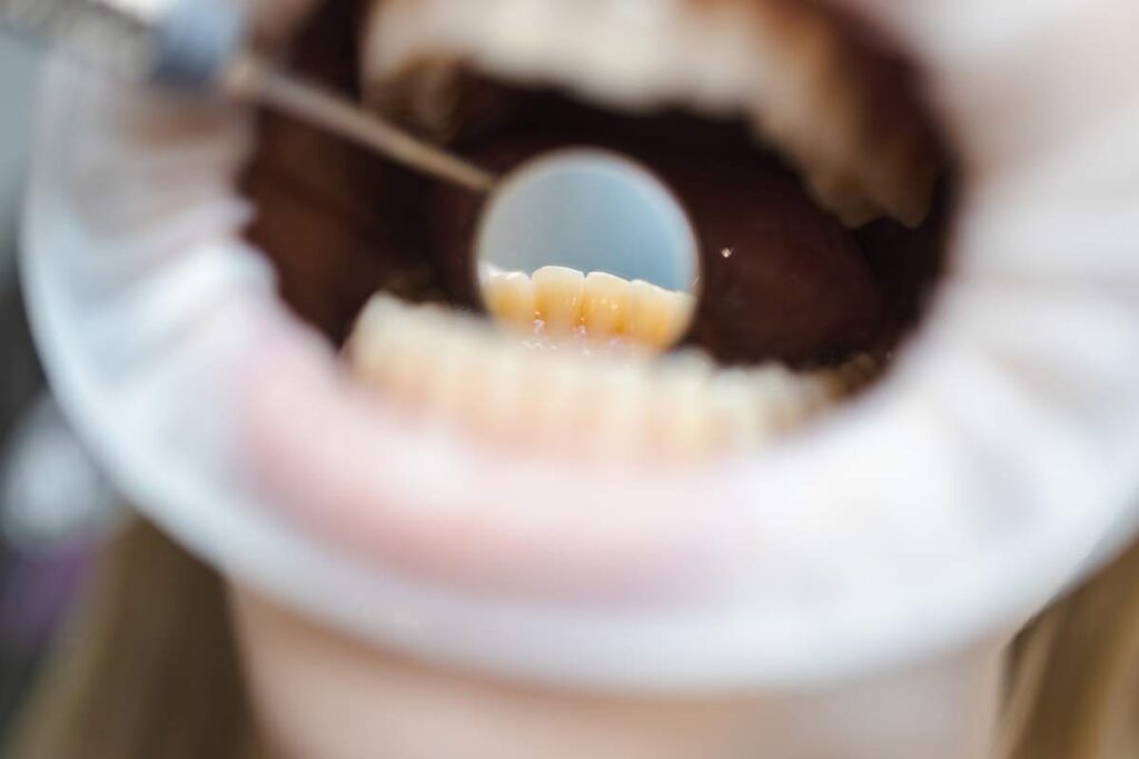 Close-up of a female patient's open mouth during a doctor's examination. Macro shot of the reflection of teeth in the dentist's mirror