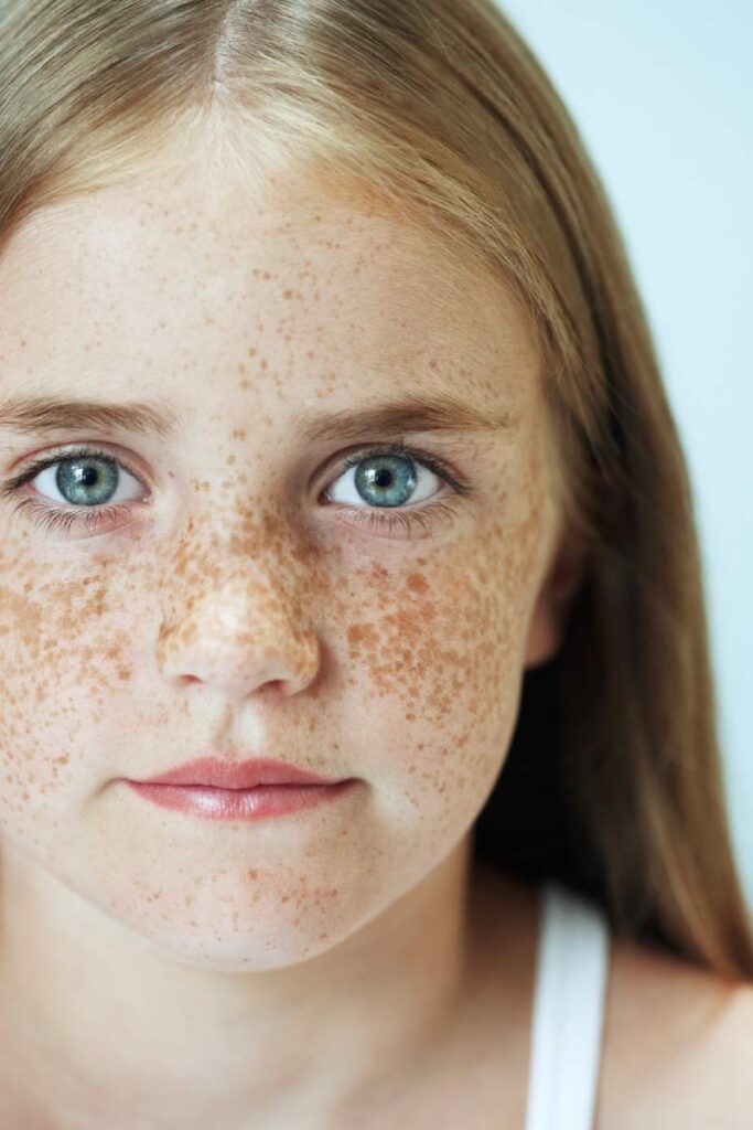 Young girl with freckles gazing forward